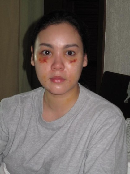 Claudine Barretto battered wife