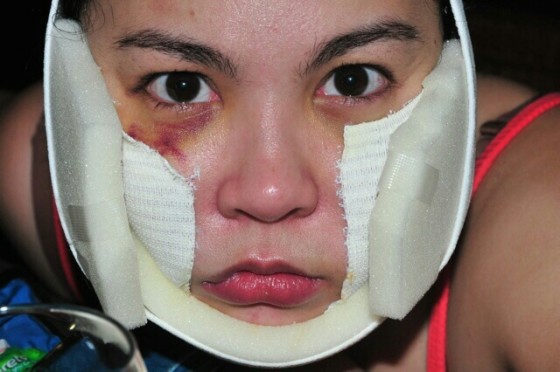 Claudine Barretto battered wife photo